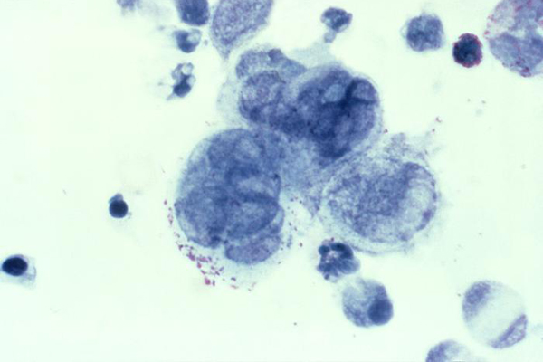 images_1912017_herpes-simplex-virus.jpg