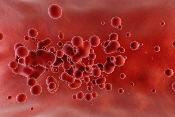 images_512017_2_Thalassemia_and_hemoglobinopathy.jpeg