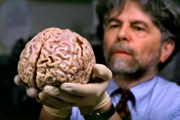 images_332017_3_4_Kalil_Ron_human_brain00_2.jpg
